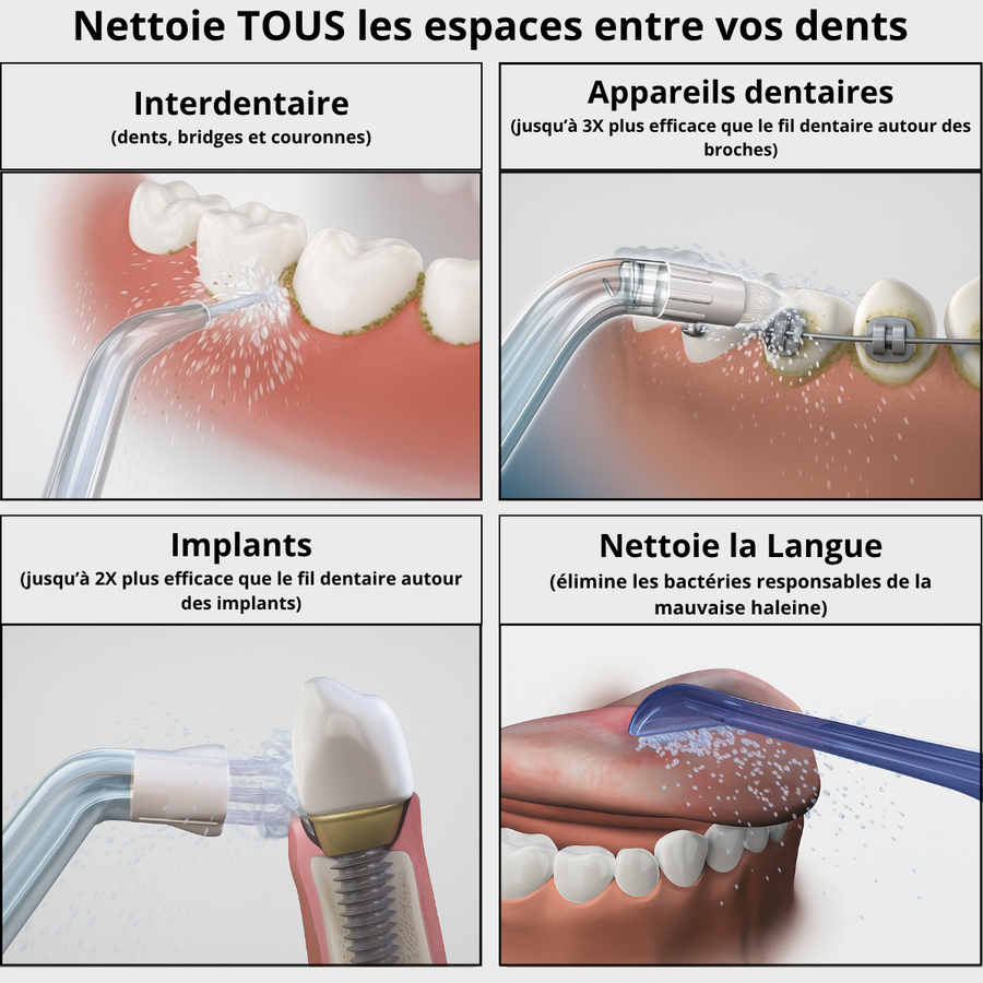 Hydropulseur Dentaire