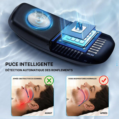Appareil Anti Ronflement Efficace