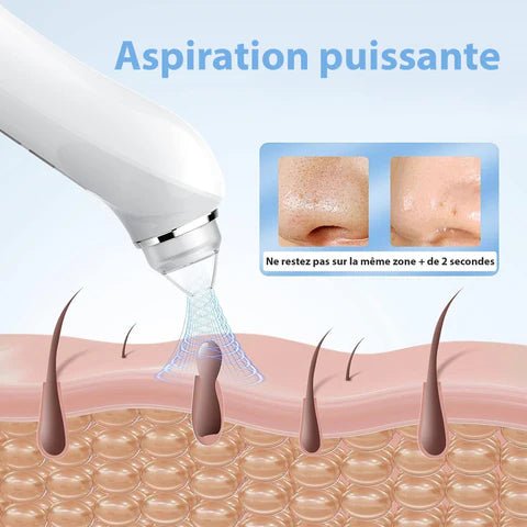 Aspirateur Point Noir avec Caméra - Nettoyeur de Pores Pro - Rondor