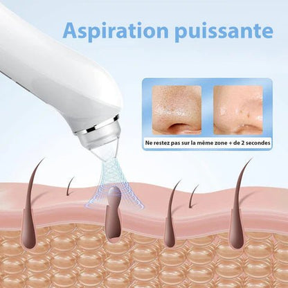 Aspirateur Point Noir avec Caméra - Nettoyeur de Pores Pro - Rondor