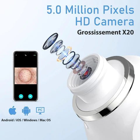 Aspirateur Point Noir avec Caméra - Nettoyeur de Pores Pro - Rondor