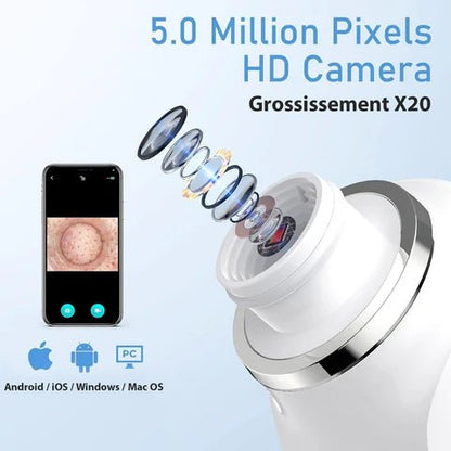 Aspirateur Point Noir avec Caméra - Nettoyeur de Pores Pro - Rondor