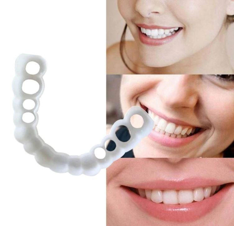 Couvre-Dents - Sourire Parfait