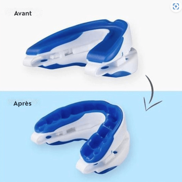 Gouttière anti - ronflement réglable SilentNight - Rondor