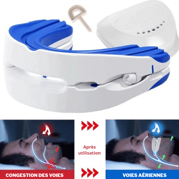 Gouttière anti - ronflement réglable SilentNight - Rondor