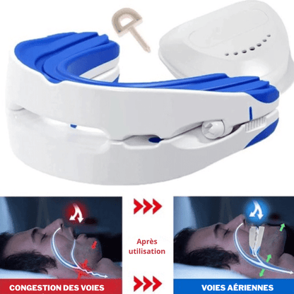 Gouttière anti - ronflement réglable SilentNight - Rondor